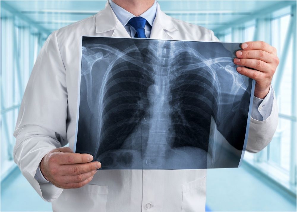 Don’t Ignore This Warning Signs of Lung Cancer